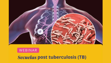 Webinar: Secuelas post tuberculosis (TB)